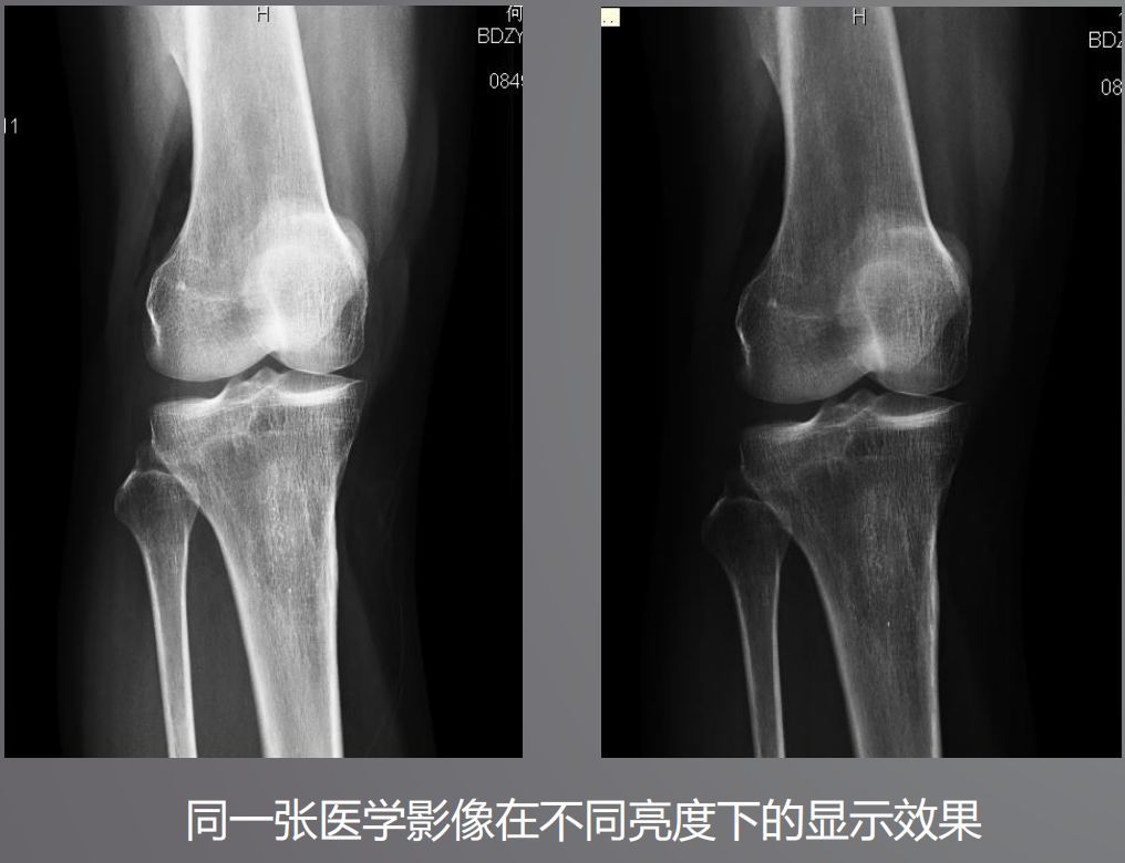 寵物DR設(shè)備的顯示器有要求？普通和醫(yī)用顯示器有什么區(qū)別