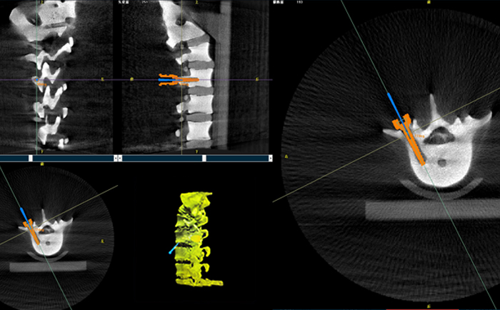 機(jī)器人手術(shù)系統(tǒng)3D影像 機(jī)器人手術(shù)系統(tǒng)3D影像